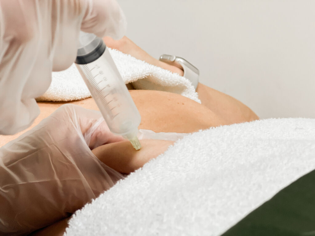 Ozonioterapia